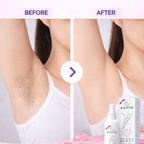 Instant Hair Removal Spray – Smooth & Painless Skin in Minutes